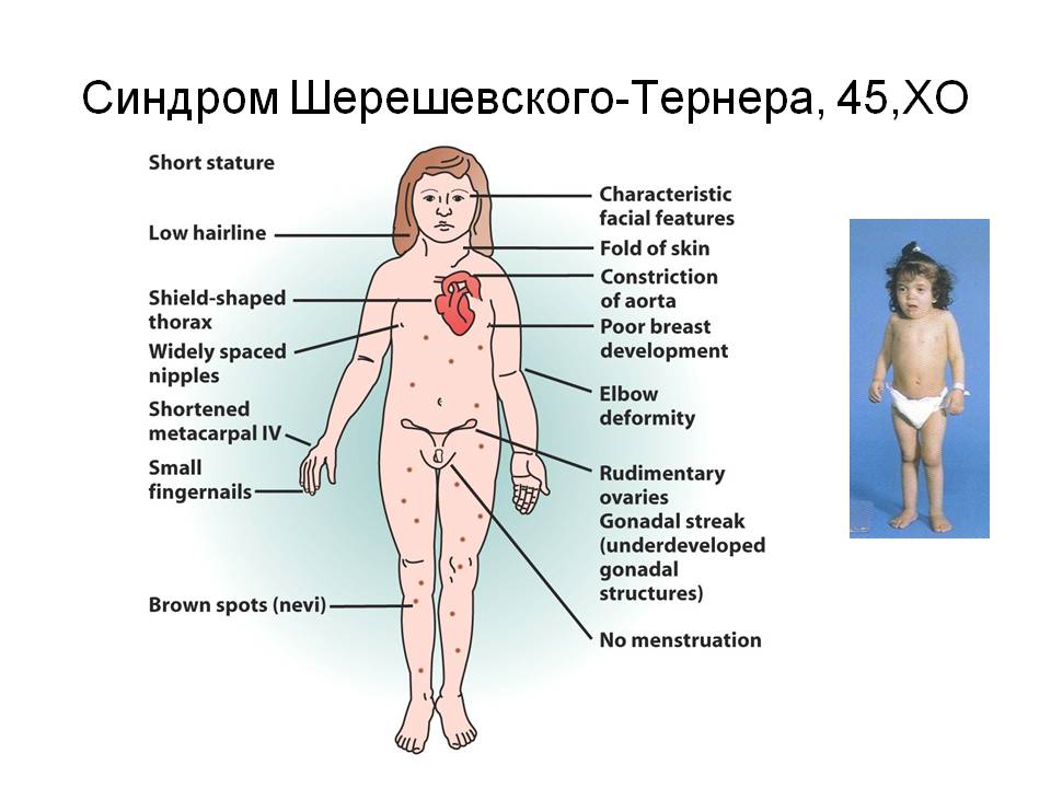 Увлекательная генетика: редкие аномалии человеческого тела (Фото)