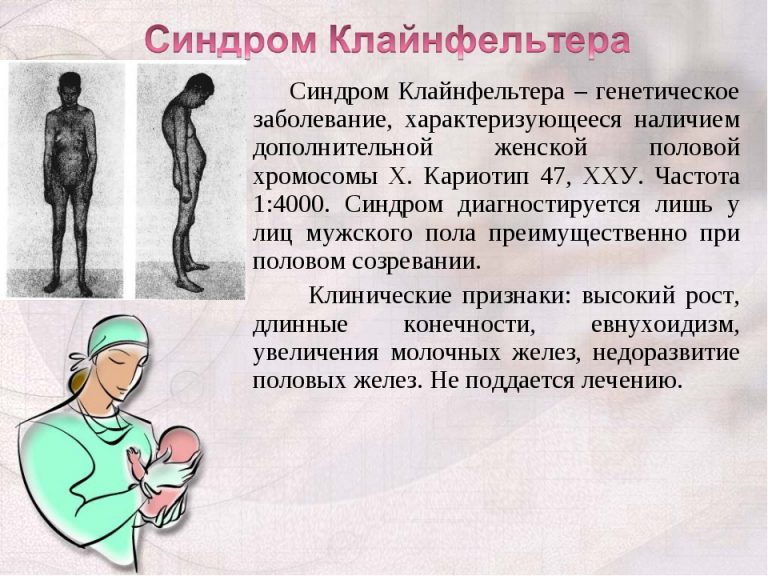 Синдром Клайнфельтера | Справка.Неинвалид.ru