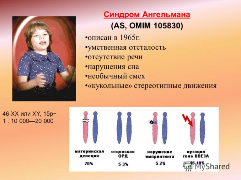 Синдром Ангельмана | Справка.Неинвалид.ru